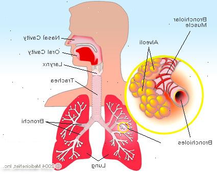 Akute Bronchitis. Was ist die akute Bronchitis? Akute Bronchitis. Was ist die akute Bronchitis?