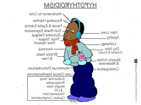 Hypothyreose. Was ist Hypothyreose? Hypothyreose. Was ist Hypothyreose?