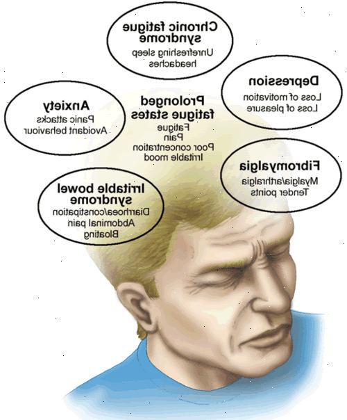 Fatigue. Wie viel Schlaf brauchen Sie? Fatigue. Wie viel Schlaf brauchen Sie?