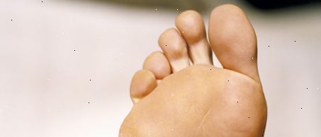 Behandlungen für Gicht Behandlungen für Gicht