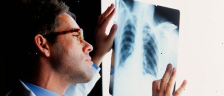 Behandlungen für Tuberkulose Behandlungen für Tuberkulose