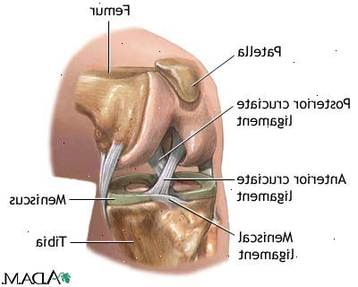 Knie-Arthroskopie. nach andndash; in Krankenhaus. Knie-Arthroskopie. nach andndash; in Krankenhaus.