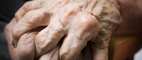 Fragen Sie den Arzt: Arthritis Fragen Sie den Arzt: Arthritis