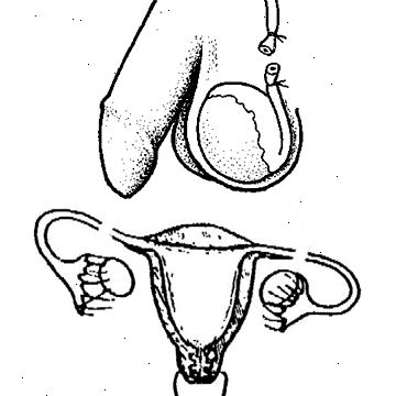 Sterilisation. nach andndash; in Krankenhaus. Sterilisation. nach andndash; in Krankenhaus.