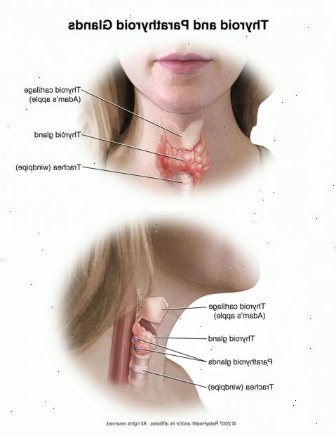 Thyroidectomy. nach andndash; in Krankenhaus. Thyroidectomy. nach andndash; in Krankenhaus.