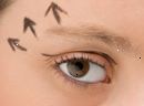 Eye Lift