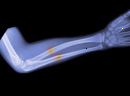 X-ray
