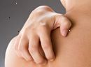 Scabies