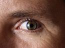 Diabetische Retinopathie