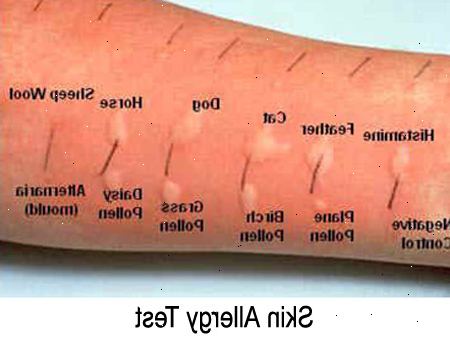Allergietests. RAST-Test. Allergietests. RAST-Test.
