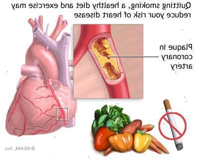 Bewegung und Gesundheit des Herzens. Wie funktioniert Übung helfen Herzkrankheit? Bewegung und Gesundheit des Herzens. Wie funktioniert Übung helfen Herzkrankheit?
