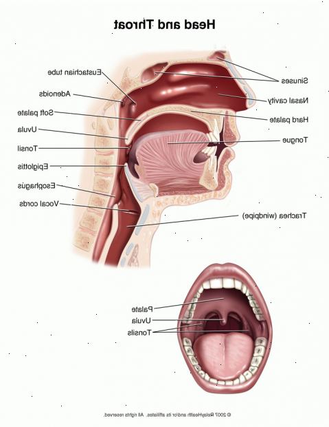 Laryngitis. was bewirkt, Kehlkopfentzündung? Laryngitis. was bewirkt, Kehlkopfentzündung?