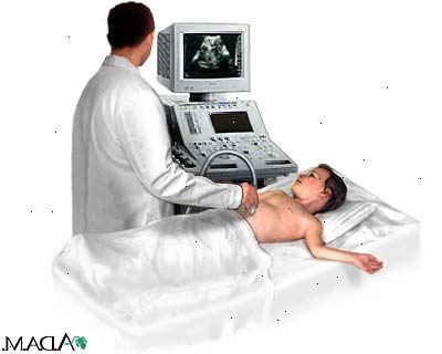 Ultraschalluntersuchungen. was sind Ultraschalluntersuchungen? Ultraschalluntersuchungen. was sind Ultraschalluntersuchungen?