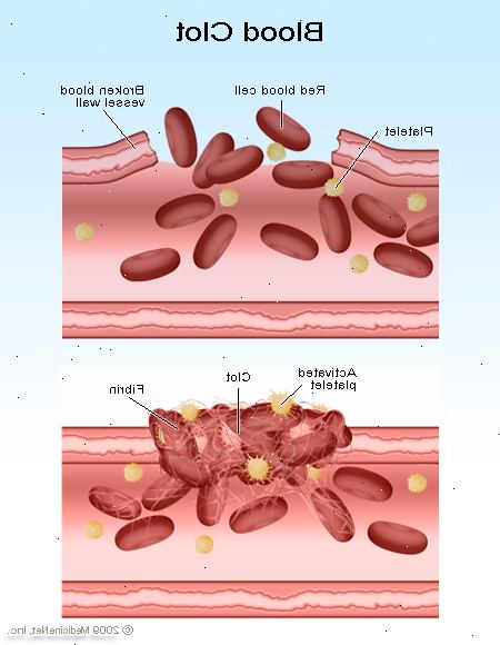 Thrombozytopenie (verringerte Zahl der Blutplättchen). falsche Thrombozytopenie. Thrombozytopenie (verringerte Zahl der Blutplättchen). falsche Thrombozytopenie.